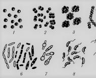Mavzu bo'yicha biologiya darsi (5-sinf) uchun Bakteriyalar qirolligi taqdimoti